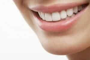 sourire blanc